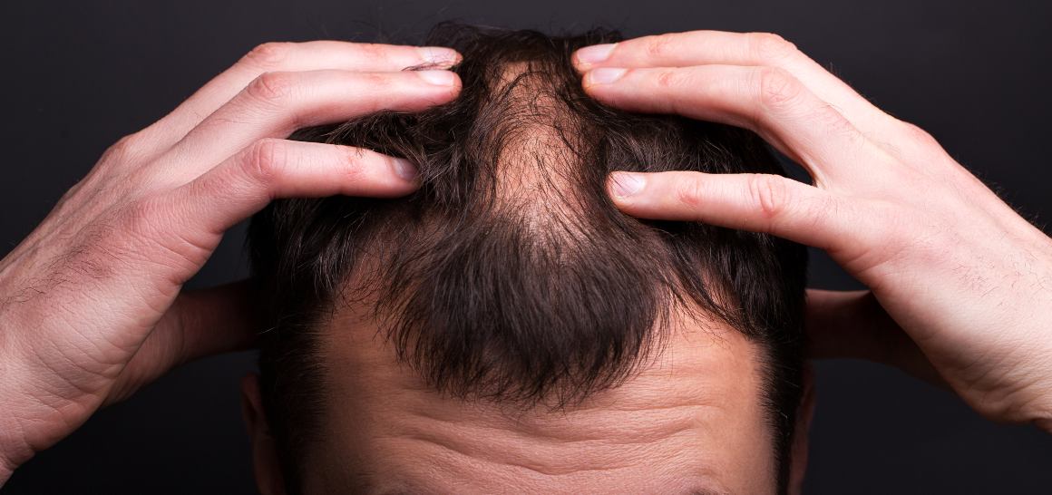 Může CBD olej pomoci vašim vlasům růst?