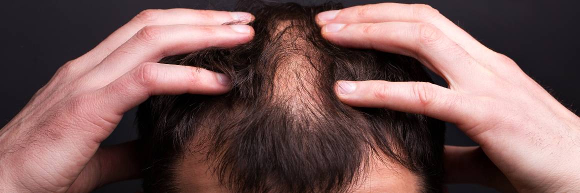 Oprava poškozených vlasových folikulů pro zdravý růst vlasů